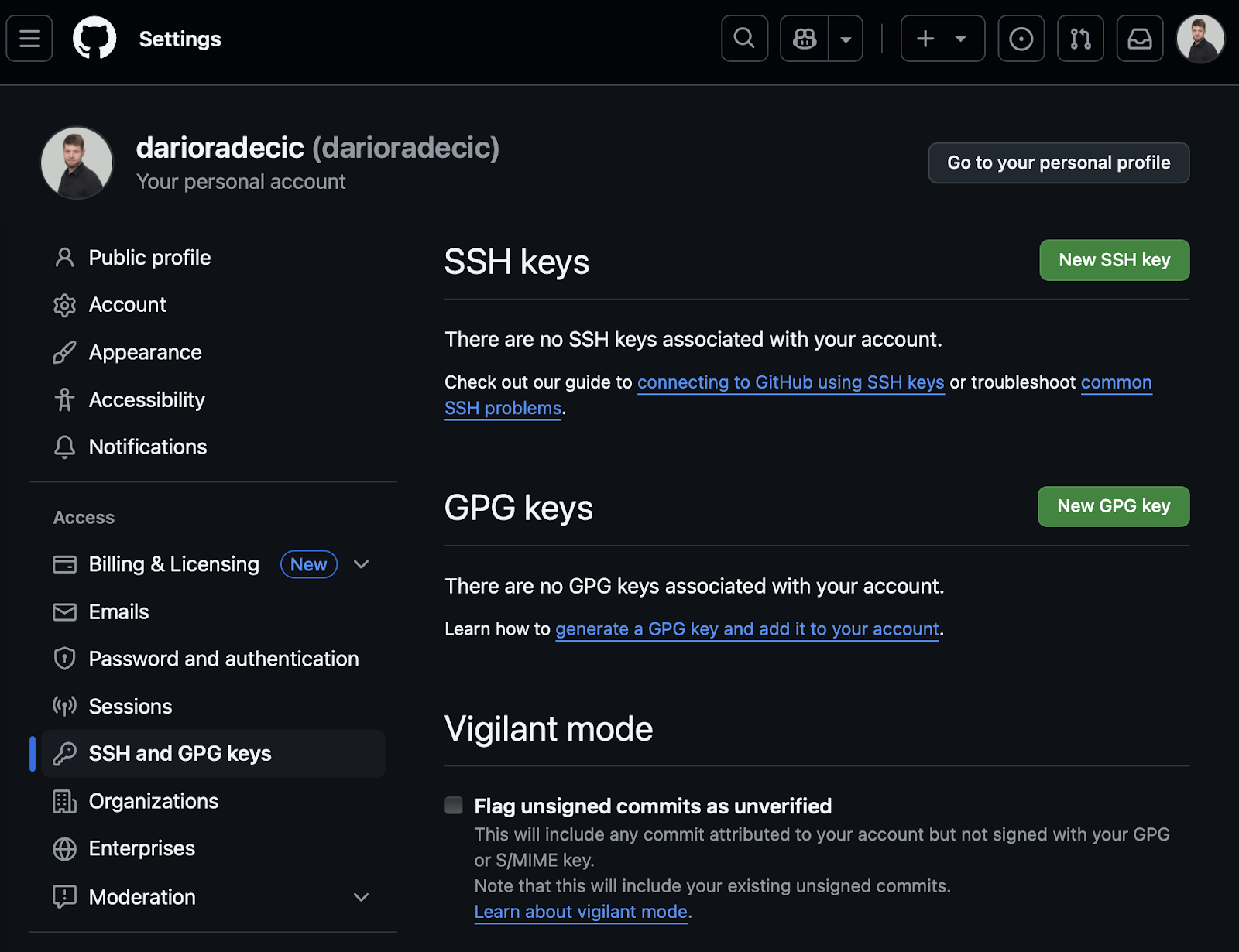 Image 10 - Configuration de l'authentification GitHub (1)