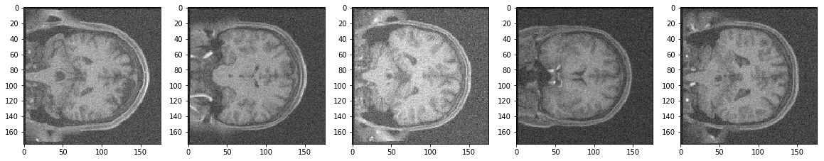 noisy test images
