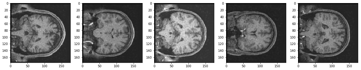 Reconstruction of Noisy Test Images